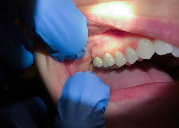 Tooth Infection Emergency Dentist in TN