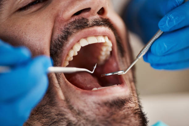 Best Cracked Tooth Emergency Dentist  in Trezevant, TN